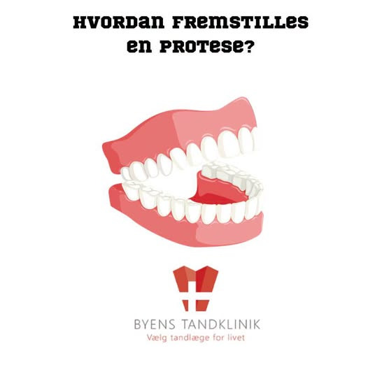Byens Tandklinik i Struer forklarer processen bag fremstilling af proteser