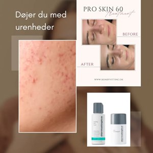 opslagsbillede