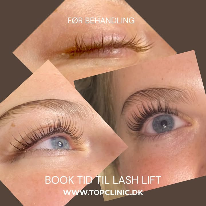 Top Clinic introducerer lash lift for naturligt smukke vipper