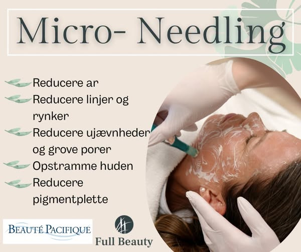 Full Beauty Aalborg tilbyder micro-needling med tre skræddersyede pakker