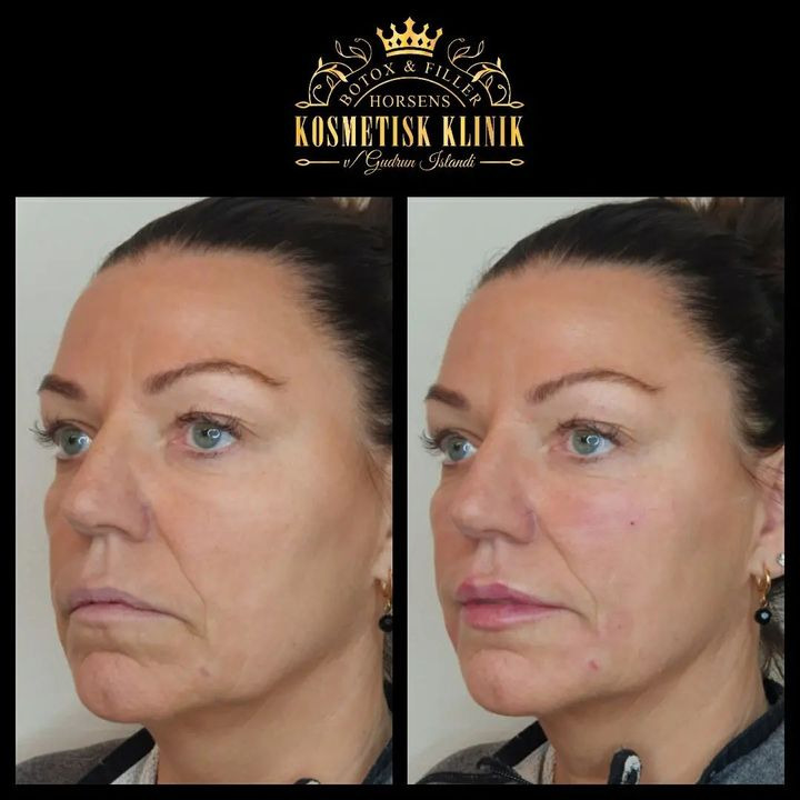 Det nyeste på Horsens’ opslagstavle