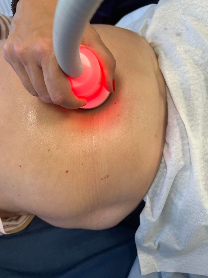 Actera Klinik Aarhus v/ Helle Hansen søger deltagere til fedtfrysning behandlinger