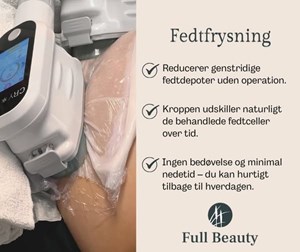 opslagsbillede