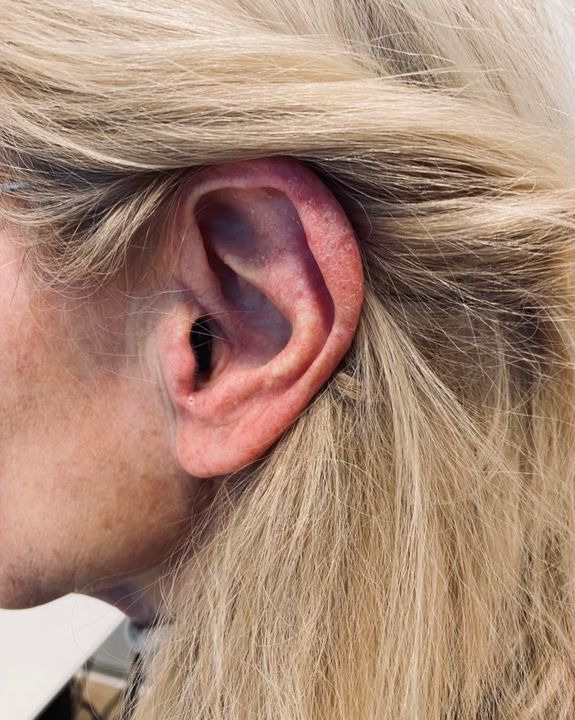 Nyt på opslagstavlen i Vejle