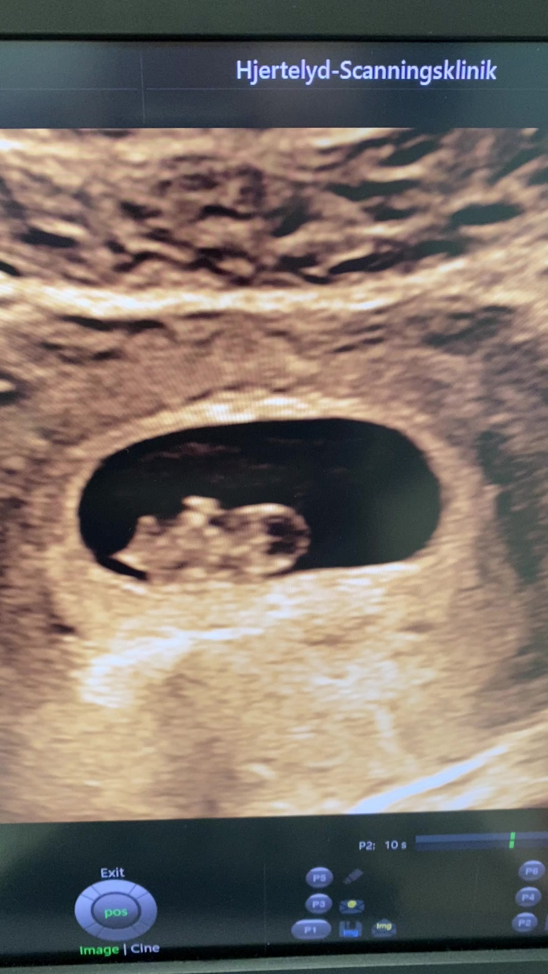 Det nyeste på Ikasts opslagstavle