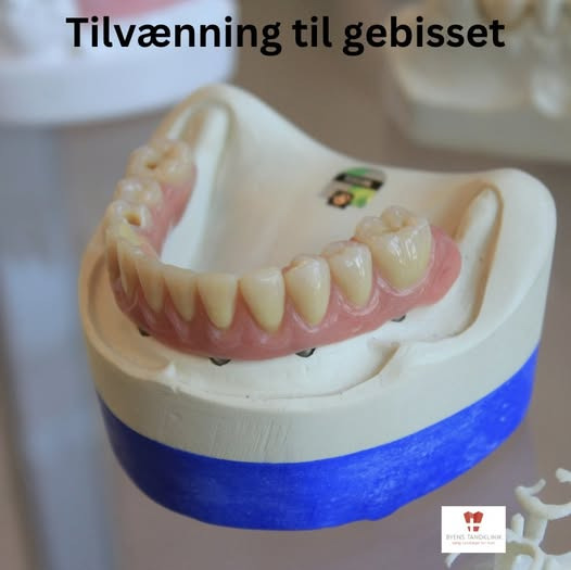Byens Tandklinik i Struer giver råd til tilvænning af tandproteser