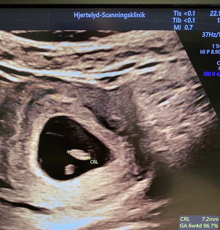 Hold trit med lokalområdet: Nyt fra Herning