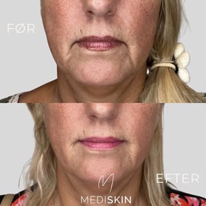 opslagsbillede