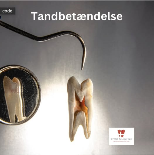 Byens Tandklinik i Struer forklarer om tandbetændelse