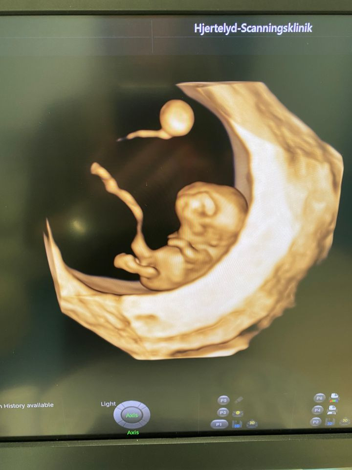 Hold trit med lokalområdet: Nyt fra Silkeborg