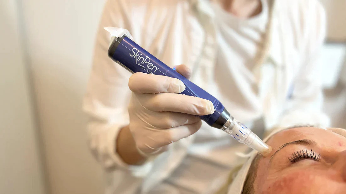 Få hudgløden tilbage med fantastisk tilbud hos Cosmo Laser Vejle