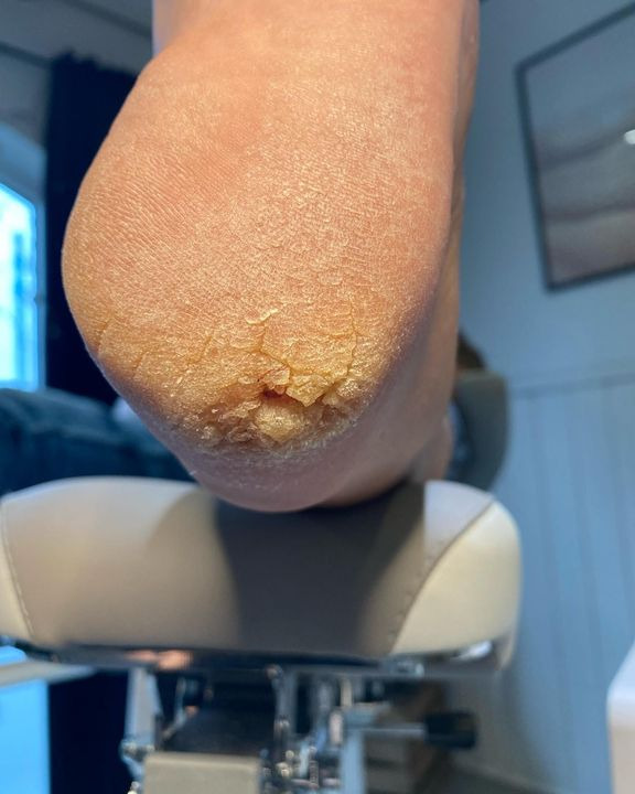 Opslagstavlen: Nyeste opdateringer fra Vejle