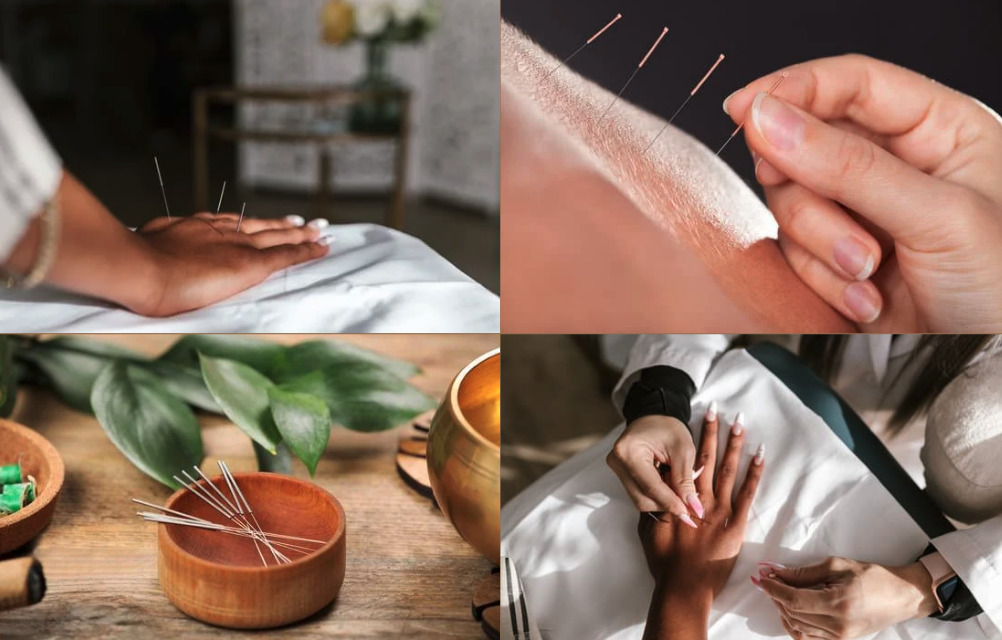 Nytårsfortsæt om vægttab? Connies Akupunktur tilbyder en alternativ tilgang