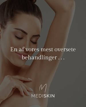 opslagsbillede