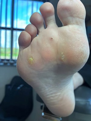 opslagsbillede