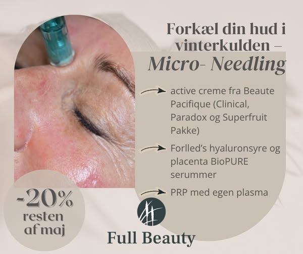 Full Beauty Aalborg giver 20% på microneedling-behandlinger resten af maj 2026