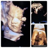 Hjertelyd - scanningsklinik for gravide: 3D/4D-scanning i uge 35+ giver ro om babys trivsel og udvikling