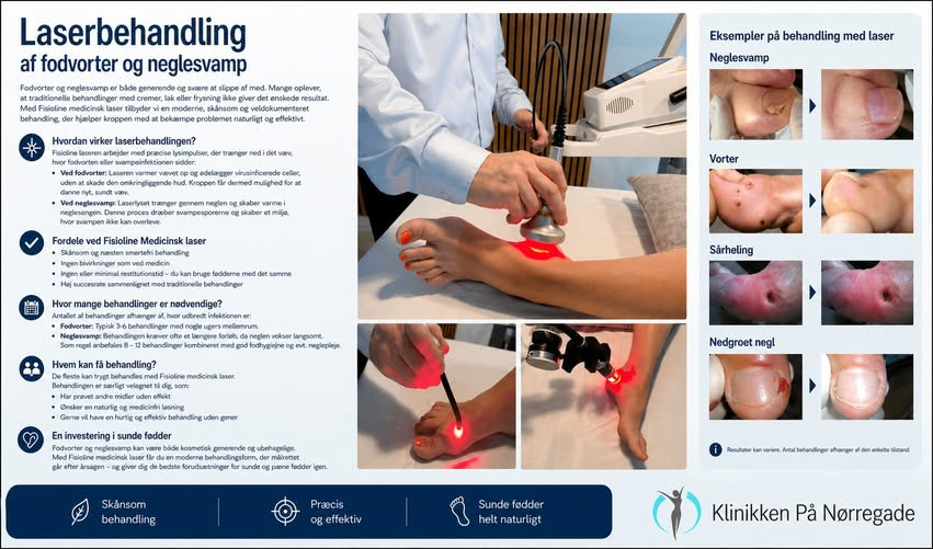 Klinikken på Nørregade tilbyder behandling af neglesvamp og fodvorter