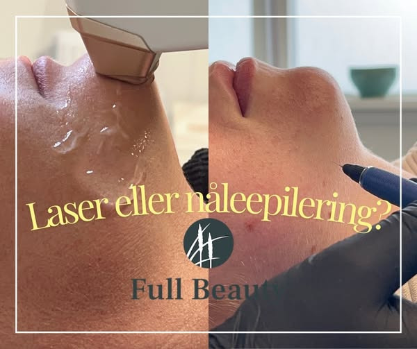 Full Beauty Aalborg forklarer forskellen på laser hårfjerning og nåleepilering