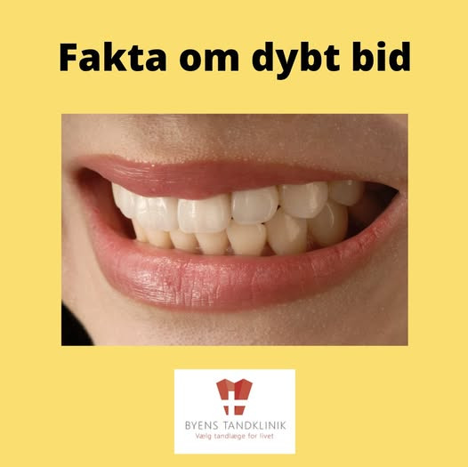 Byens Tandklinik i Struer informerer om dybt bid og behandlingsmuligheder