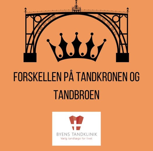 Byens Tandklinik forklarer fordele ved tandkroner og tandbroer