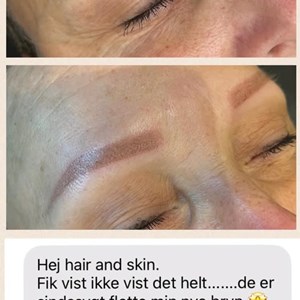 Opslagsbillede
