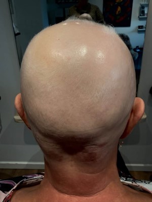 opslagsbillede