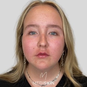 opslagsbillede