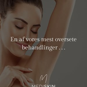 Opslagsbillede