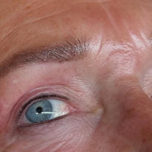 Opslagsbillede