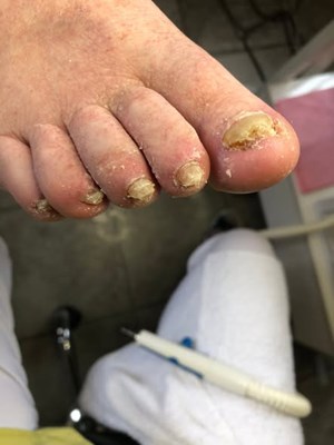 opslagsbillede