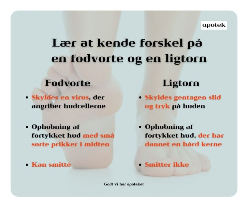 Vejlby Apotek forklarer forskellen mellem fodvorter og ligtorne