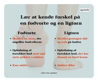 Vejlby Apotek forklarer forskellen mellem fodvorter og ligtorne