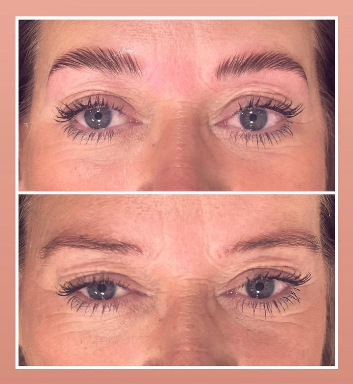 Smuk By Læsø tilbyder BrowLift for fyldige og velformede bryn