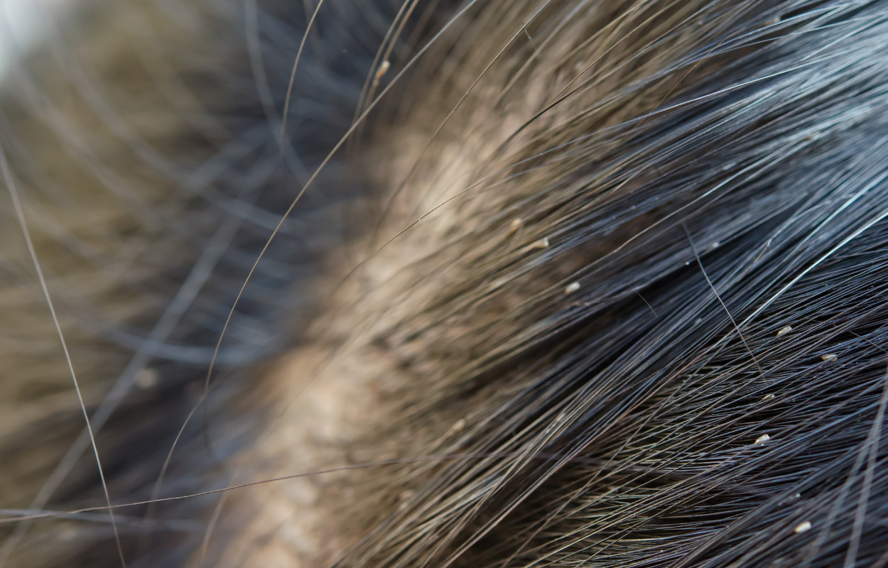 VÆK MED LUS – fælles front mod lusene