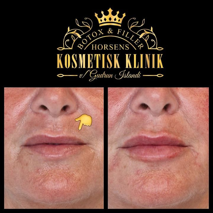 Hold dig ajour med dagens opdateringer fra Horsens