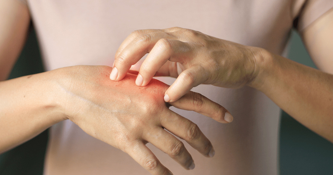 Nyt på opslagstavlen i Risskov