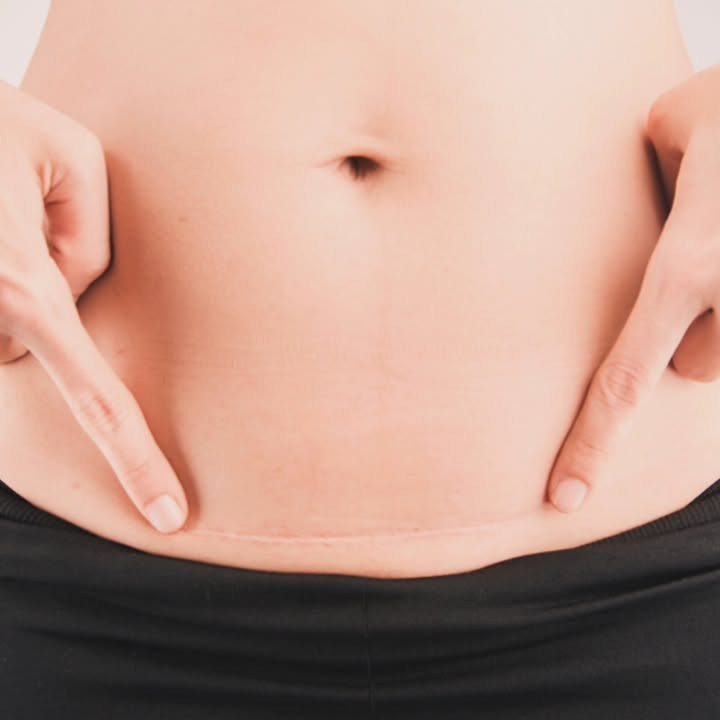 Brandsborgs Kropsterapi tilbyder laserbehandling for optimal sårheling