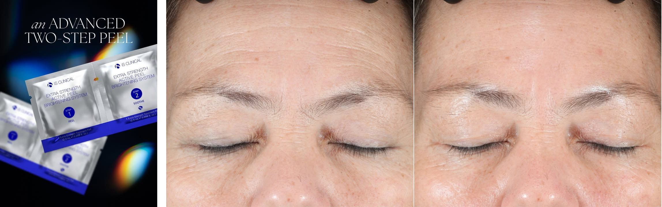 Top Clinic præsenterer iS CLINICALs nye brightening system for huden