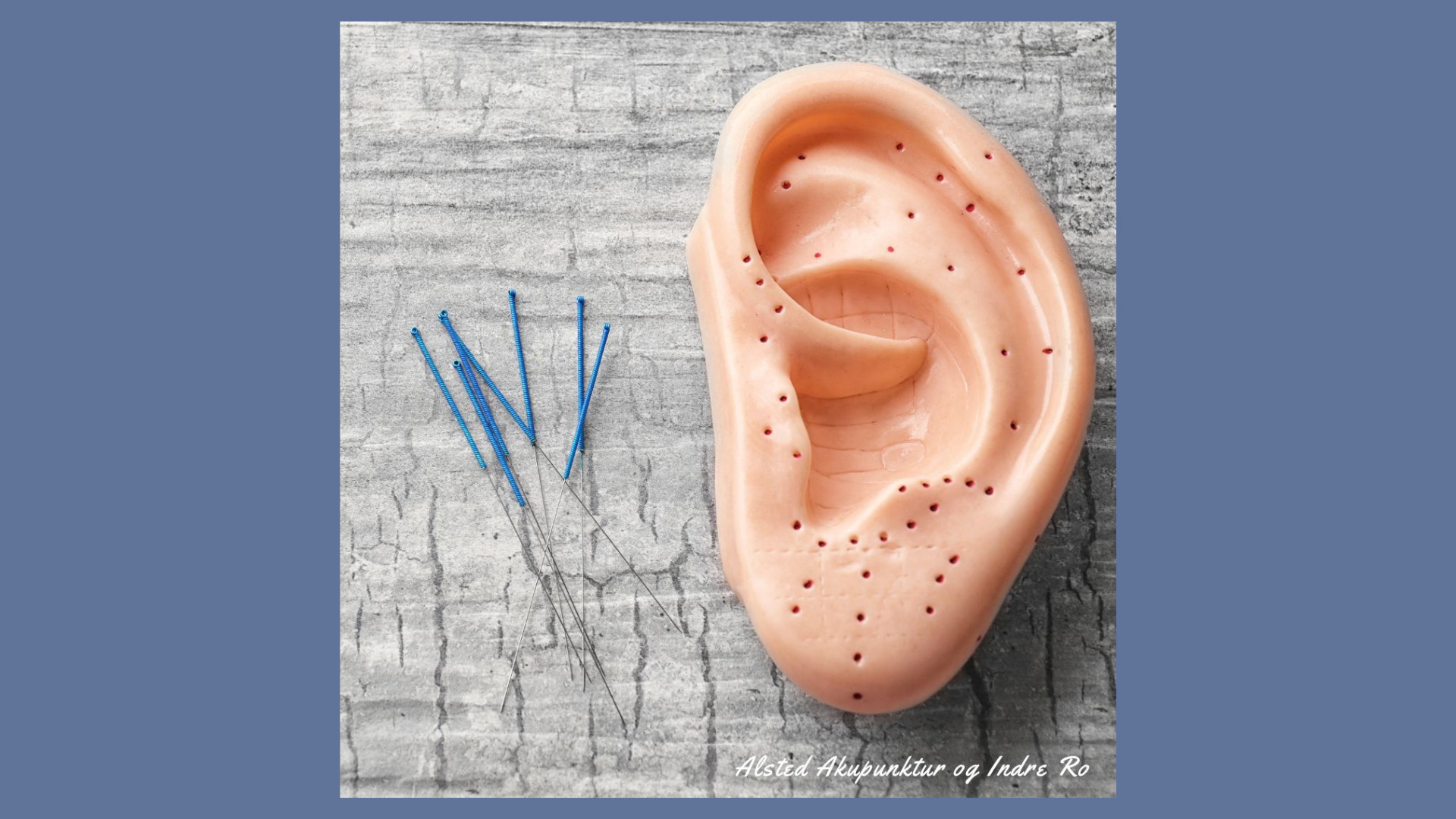 Opnå indre ro med 5-punkts øreakupunktur hver tirsdag