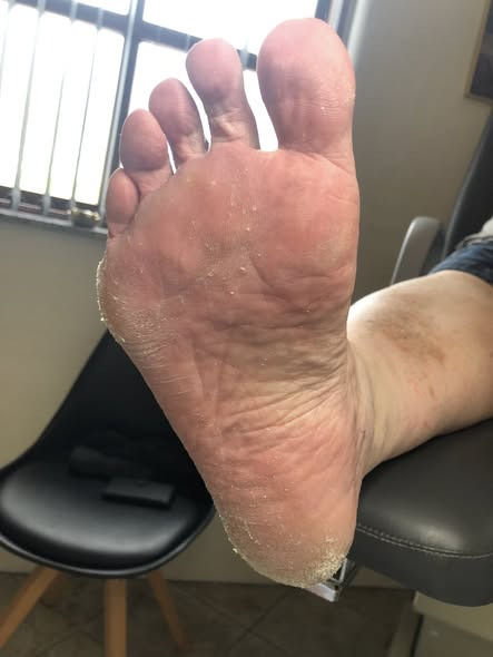 Fodterapeutisk Klinik v/Lajla Andersen har fokus på forebyggende fodterapi for diabetikere