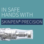 Top Clinic v/Else Møller Larsen tilbyder behandling med SkinPen Precision for smuk og ensartet hudstruktur