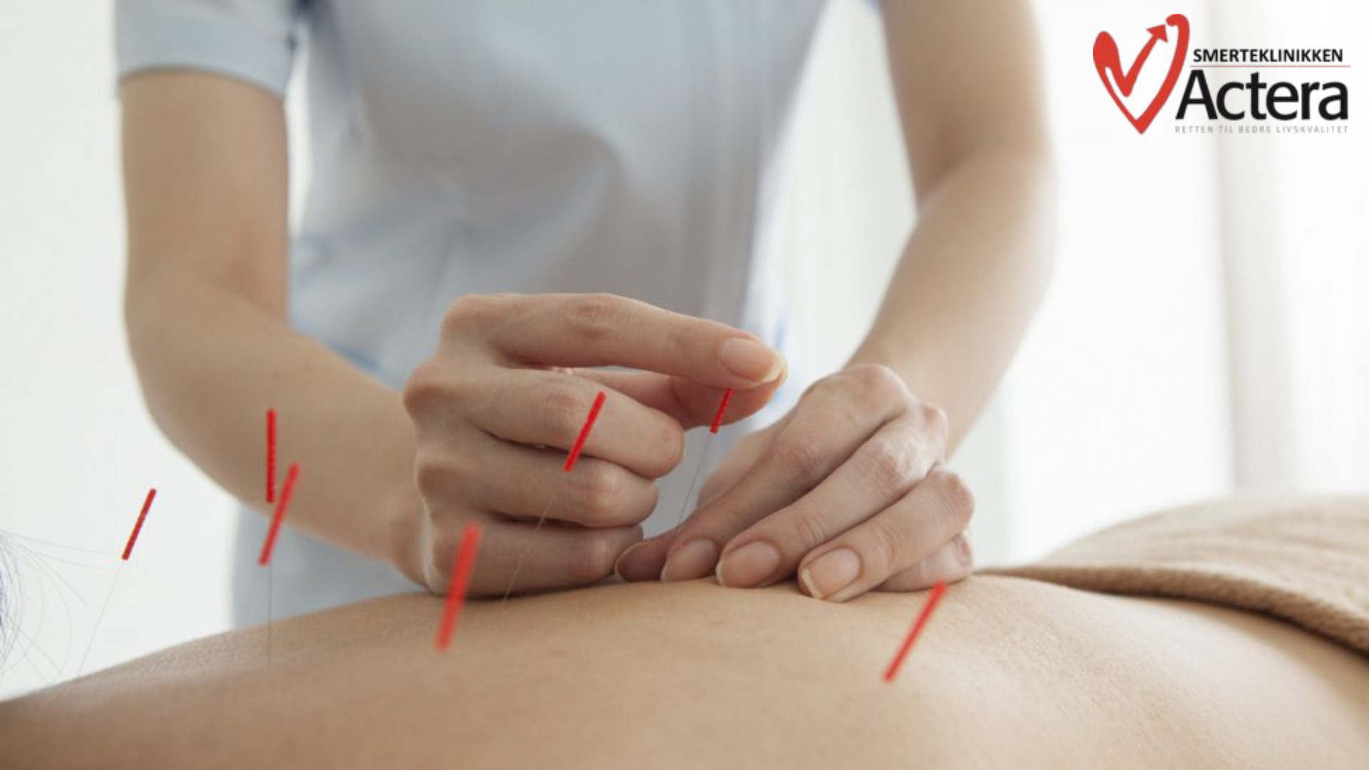 Effektiv smertelindring og heling hos Actera Klinik Aarhus