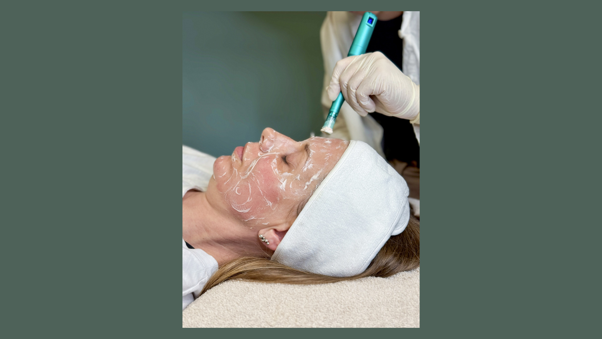 Cosmo Laser i Vejle inviterer til eksklusiv PRP-event