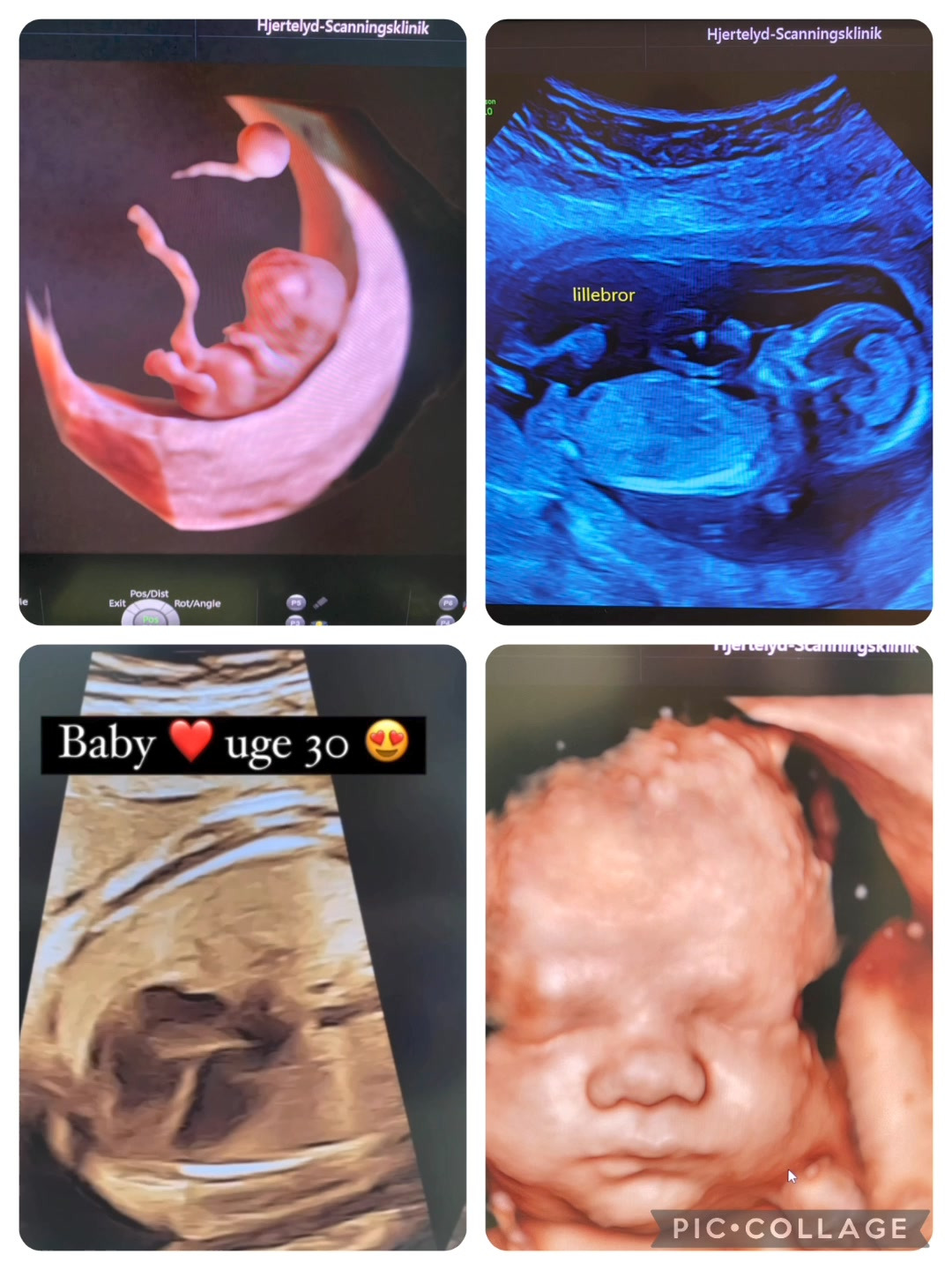 Hjertelyd: Certificerede sonografer tilbyder bred vifte af scanninger for gravide i lokal klinik