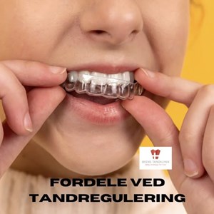 Opslagsbillede