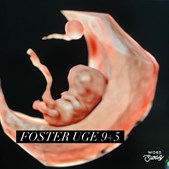 Hjertelyd - scanningsklinik for gravide fejrer næsten 20 års erfaring med scanning af nye liv