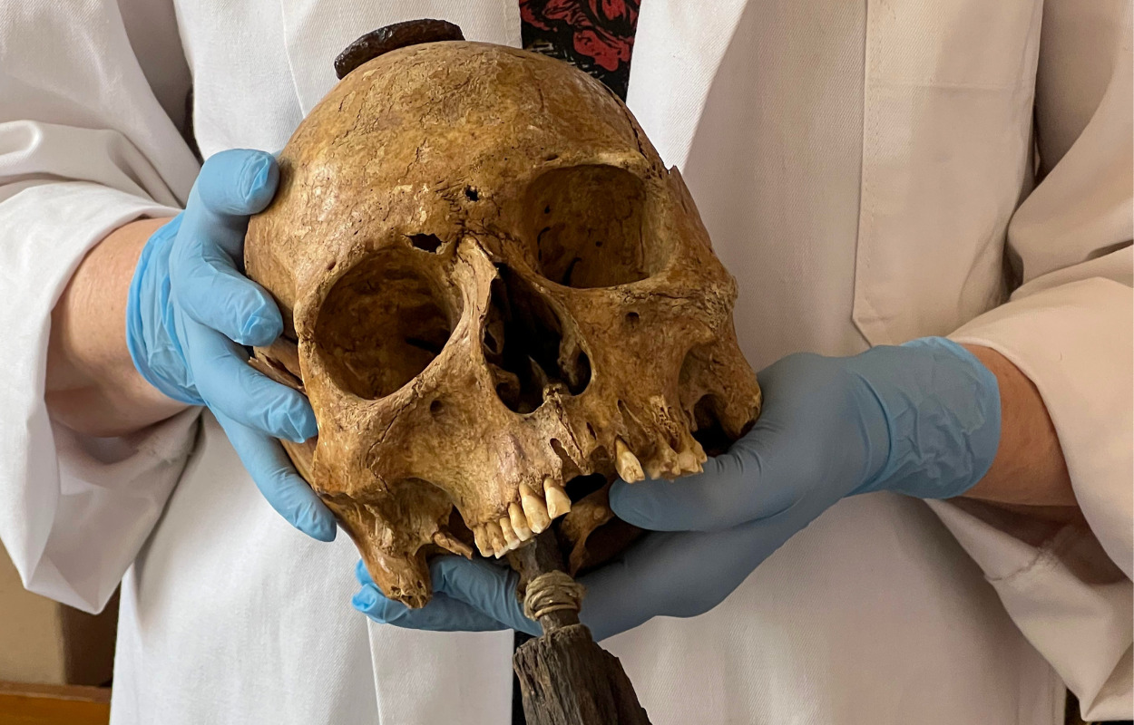 Blodbadet i Hjørring Bjerge for 200 år siden