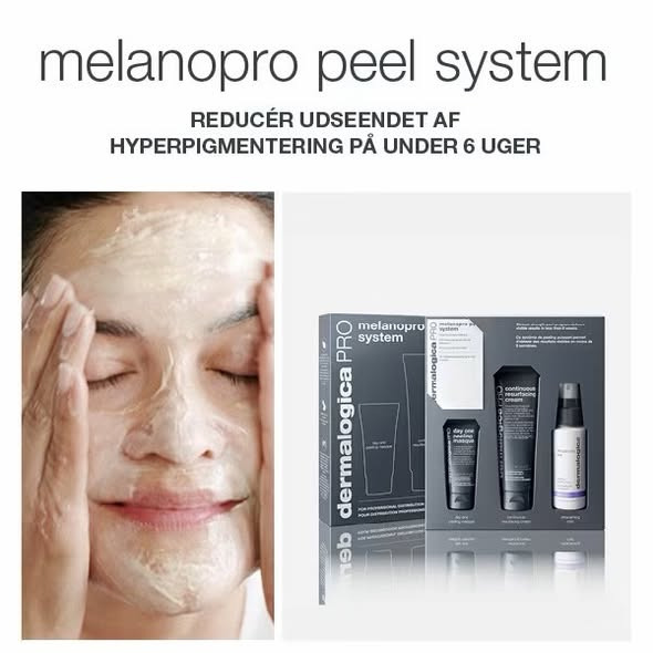 Viborg Hudpleje tilbyder Melanopro Peel System til 1.500 kr.