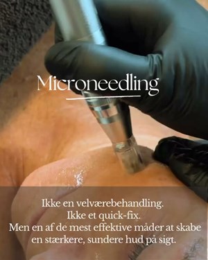 opslagsbillede